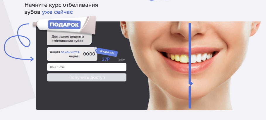 отбеливание зубов луганск